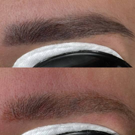 Brow & Glow #novisad Laserski tretmani lica Lasersko uklanjanje obrva
