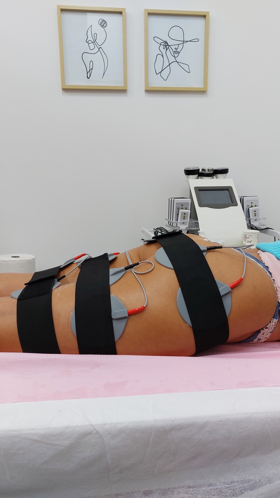 Andromeda Beauty Studio #beograd Elektrostimulacija mišića Elektrostimulacija mišića