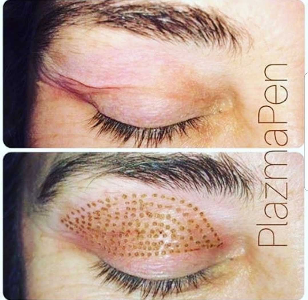 Grossi cosmetic #beograd Tretman lica