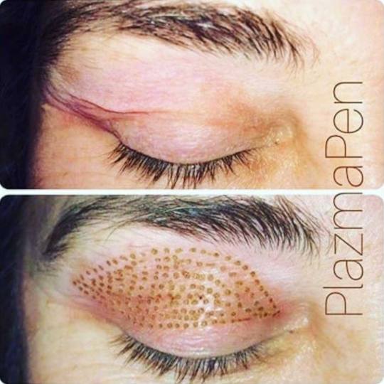 Grossi cosmetic #beograd Tretman lica