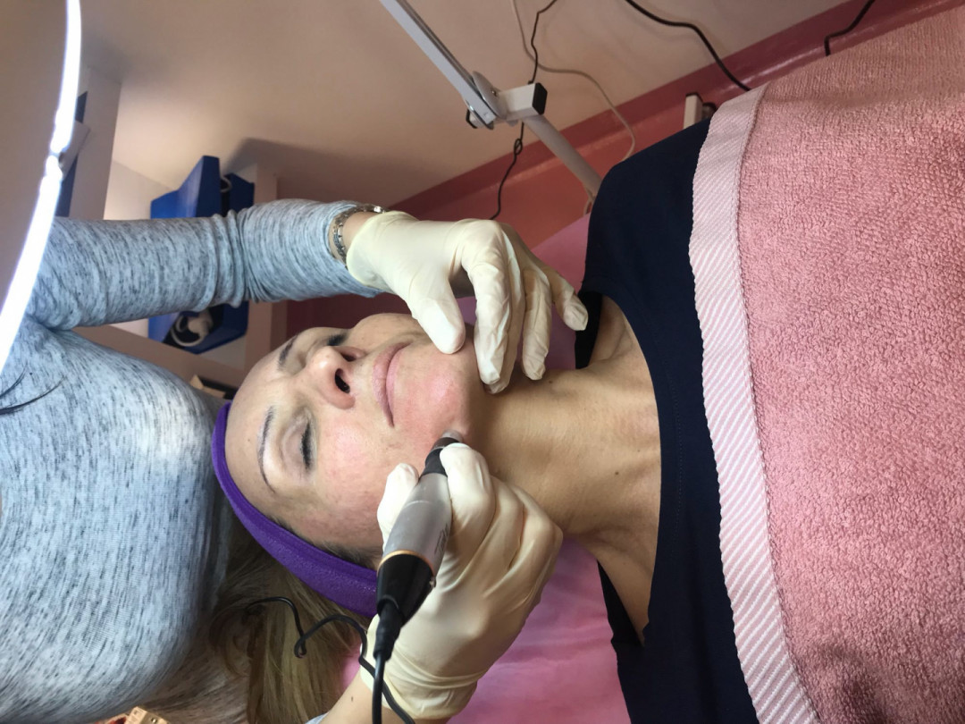 Body Beauty Balance 2020 #beograd Dermaroler i dermapen