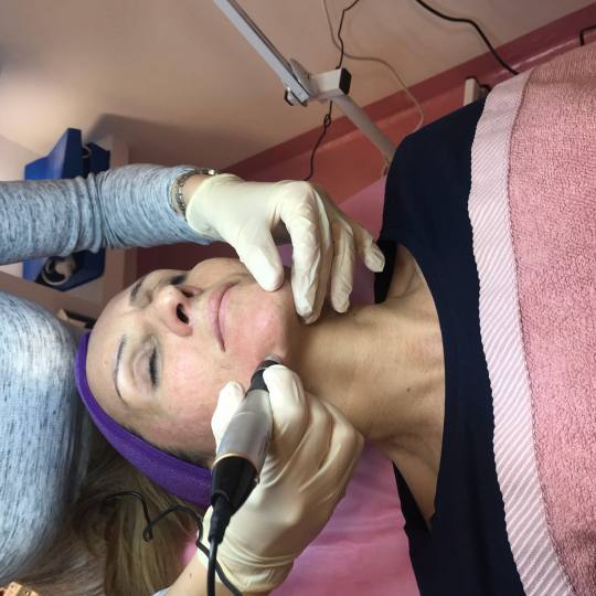 Body Beauty Balance 2020 #beograd Dermaroler i dermapen