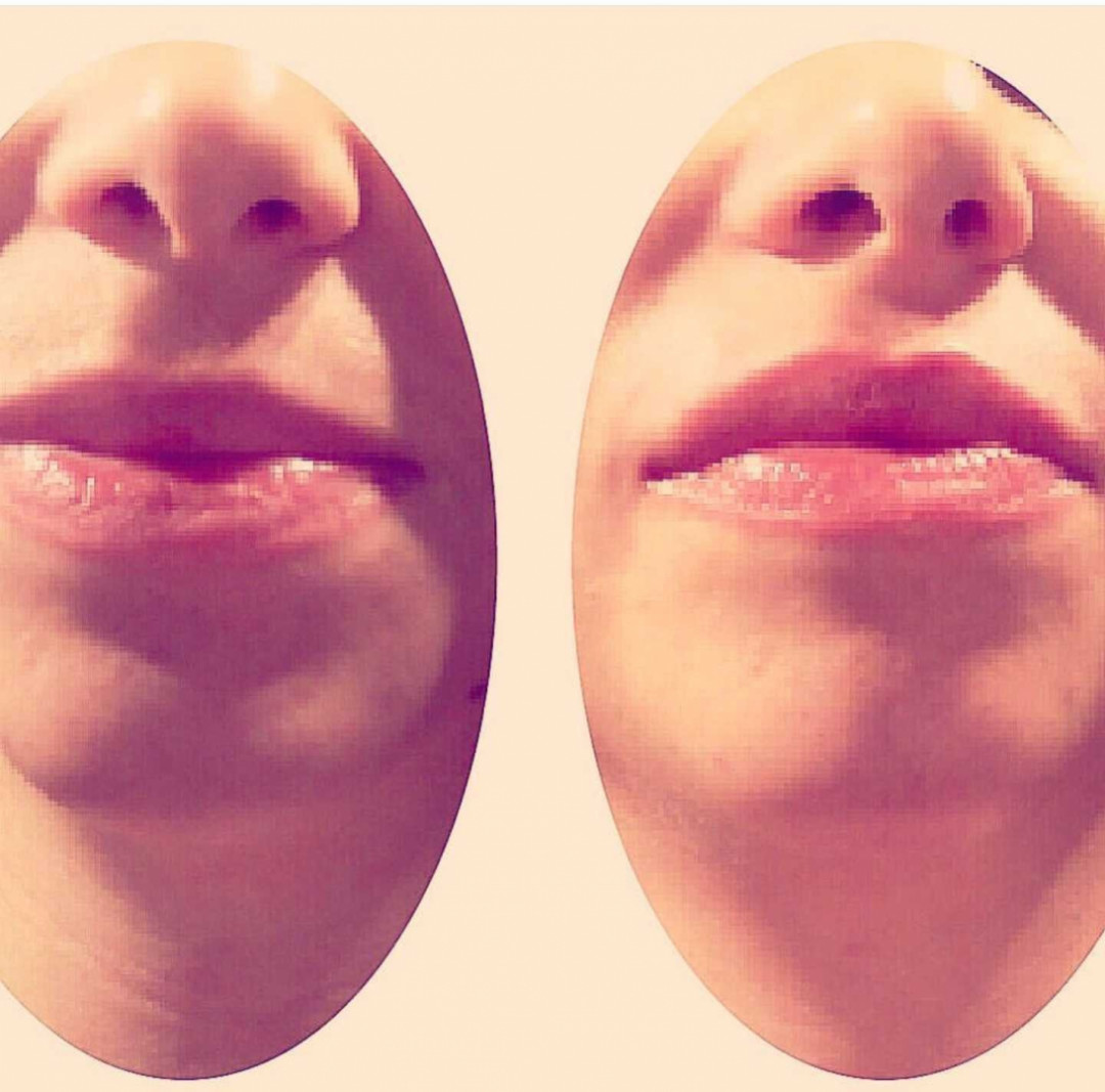 Grossi cosmetic #beograd Tretman lica