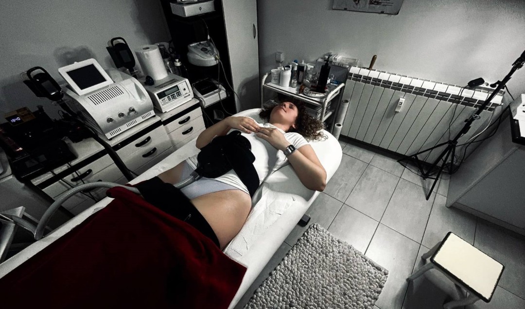Korektiv tim #beograd Tretmani tela EMS V sculpting tretman - paket od 6 tretmana