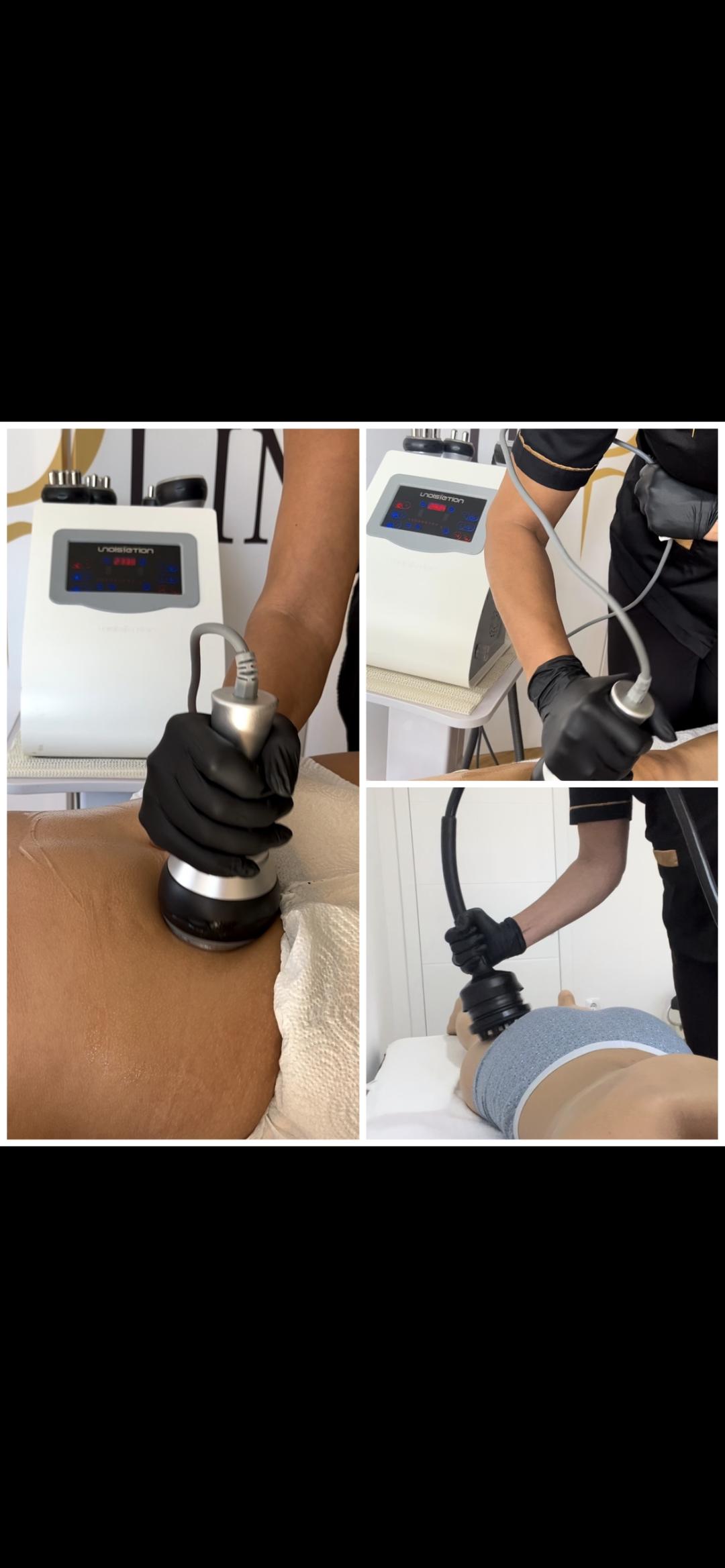 Kavitacija - po regiji - Belle Ana, Beograd Kavitacija Telo Kavitacija, Beograd, Vračar, Čubura, Crveni krst