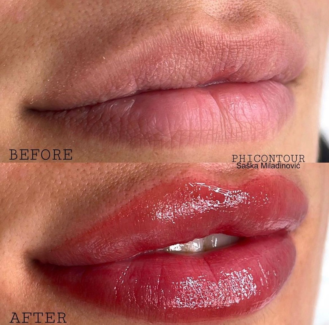 Esthetique Privé #beograd Trajna šminka Trajna šminka usana - PHILIPPS