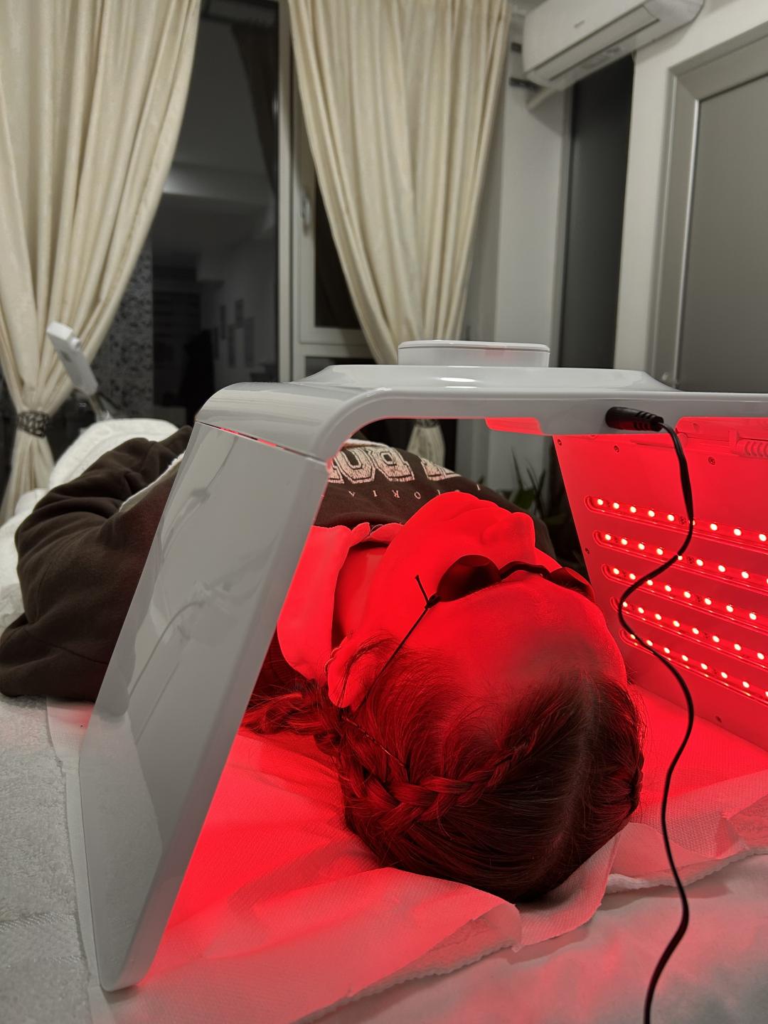 Sandra estetik studio #beograd Tretman lica Dermapen tretman lica