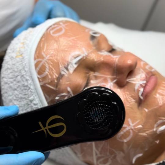 Studio Change #beograd Tretman lica Higijenski tretman lica + microneedling