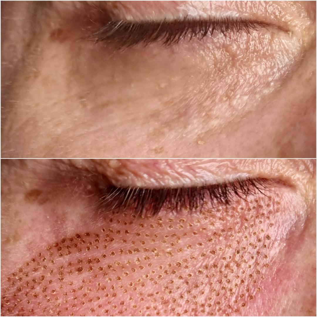 Manja pmu & beauty studio #pancevo Tretman lica Phi-Ion tretman - donji kapci