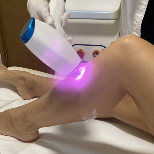 D&D Beauty Center #beograd Laserska epilacija Laserska epilacija pola nogu - za dame