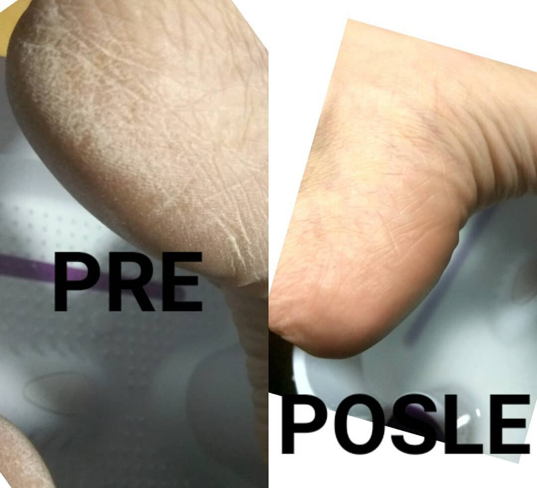 Nail Studio MPN #beograd Estetski pedikir