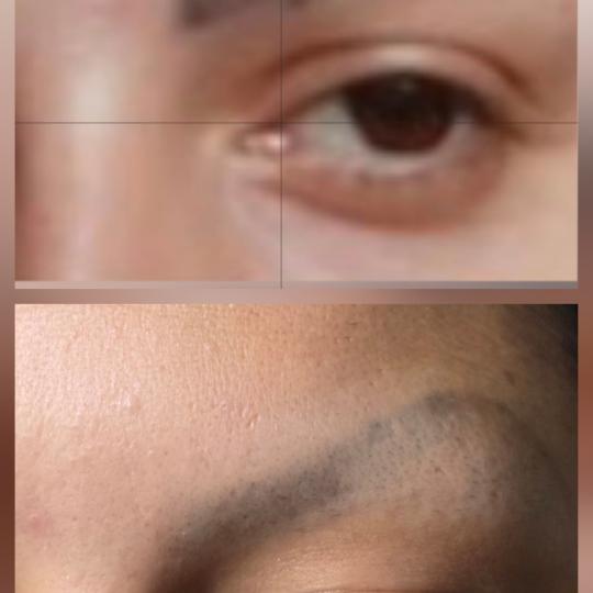 Laser centar Delight usluga