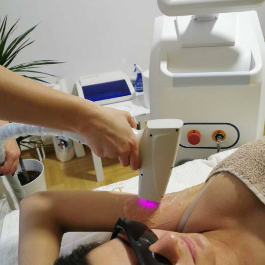 D&D Beauty Center #beograd Laserska epilacija Laserska epilacija pazuha - za dame
