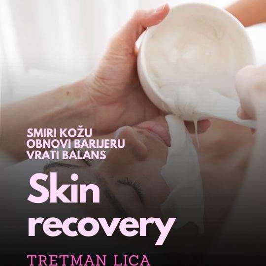 Estetik #beograd Tretman lica Skin recovery tretman lica