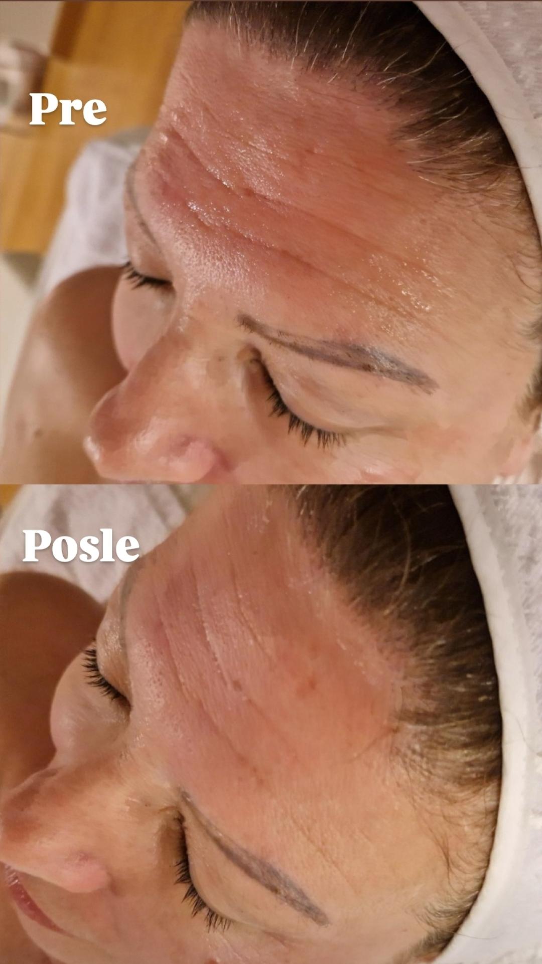 Glow Holistic Studio #beograd Masaža lica Phyt's tretman - aromalliance anti-age oligo-vital