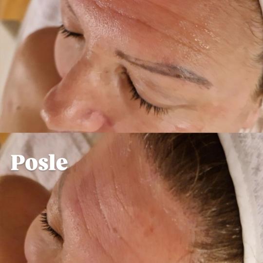 Glow Holistic Studio #beograd Masaža lica Phyt's tretman - aromalliance anti-age oligo-vital T