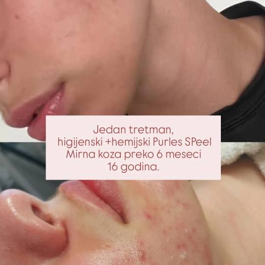 LYS by Royal Beauty Switzerland usluga