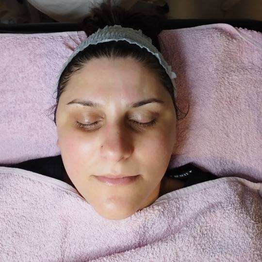 Beauty in Style DM #novisad Tretman lica Hemijski piling za akne