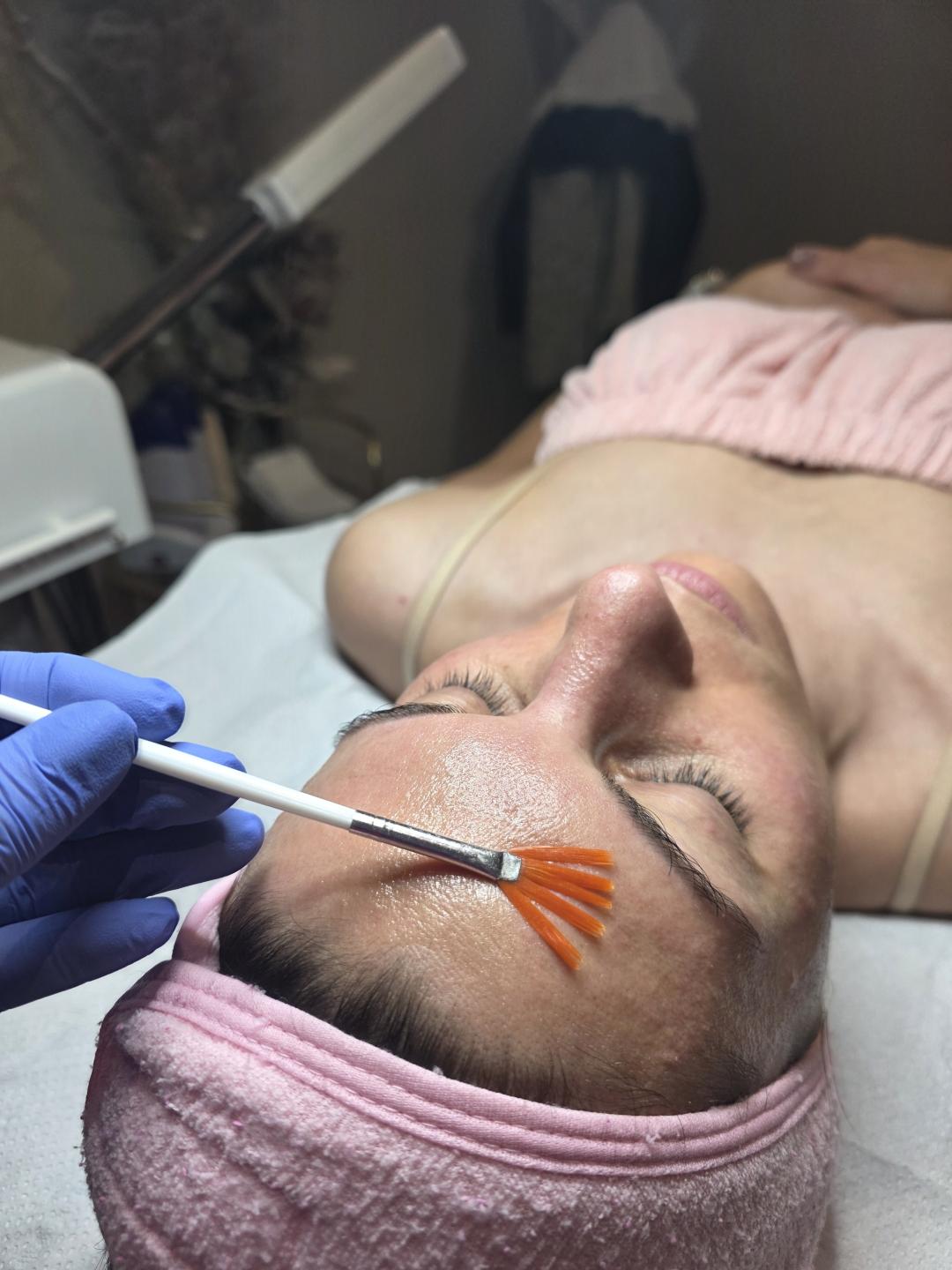 Holivudski sjaj - Jessner - Starmedic, Beograd Dermaroler i dermapen Lice Dermaroler i dermapen, Beograd, Vračar, Čubura, Crveni krst