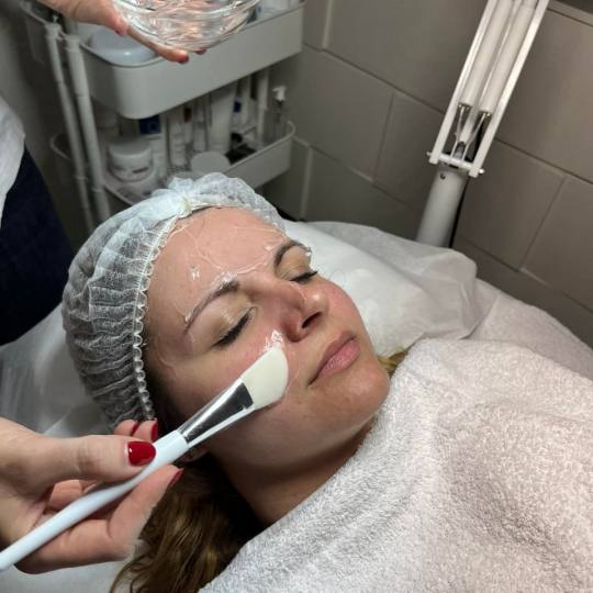 Freya 1 #beograd Tretman lica Biodroga hemijski piling voćnim kiselinama