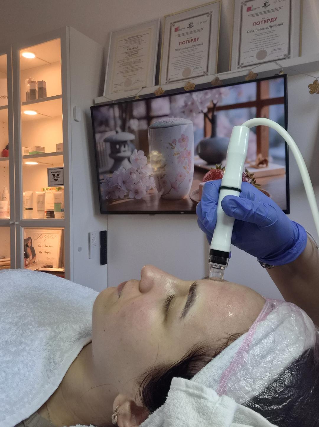 Holivudski tretman lica - mikrodermoabrazija + hydrafacial - Oladoria Rituals, Novi Sad Tretman lica Lice Tretman lica, Novi Sad, Sajmište, Detelinara, Banatić