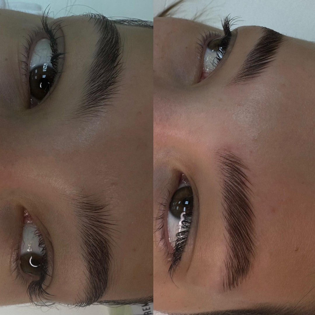 Natalis #beograd Obrve Brow lift