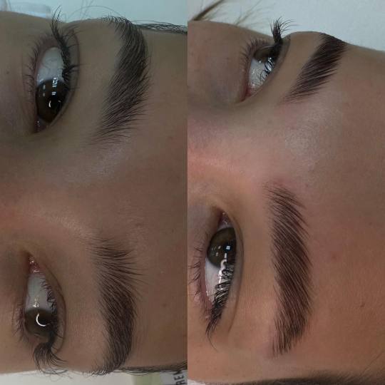 Natalis #beograd Obrve Brow lift