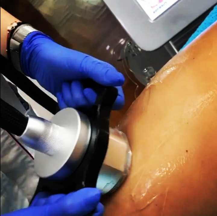 Sonnet beauty concept center #beograd Tretmani tela Kavitacija + vaccuslim