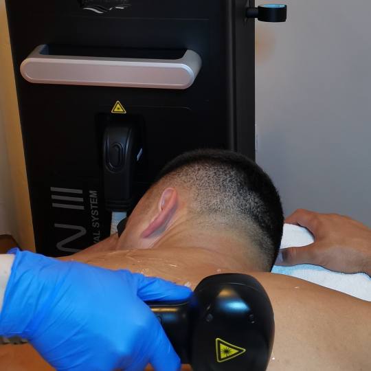 Glow beauty studio #beograd Laserska epilacija Laserska epilacija leđa - za muškarce