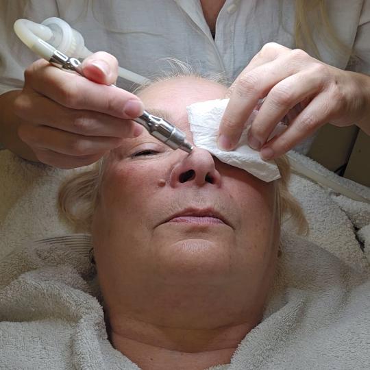 Laser lab by Ceca #novisad Mikrodermoabrazija Dijamantska mikrodermoabrazija + piling + komodoekspre