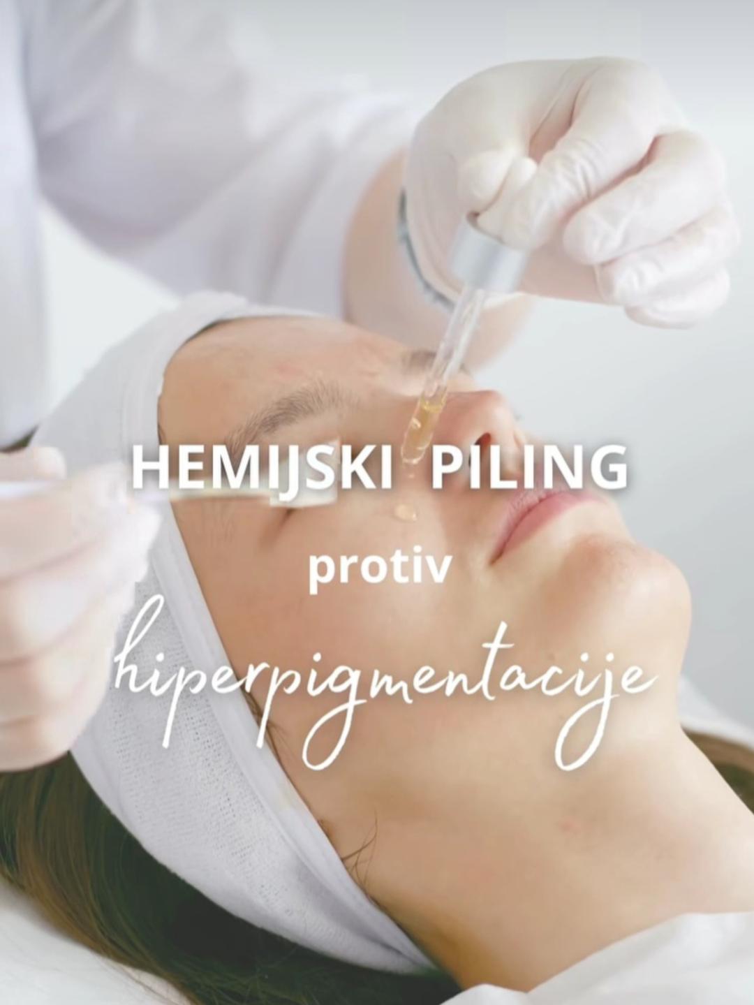 Hemijski piling lica - Afrodita gold 2, Kragujevac Tretman lica Lice Tretman lica, Kragujevac, Centar