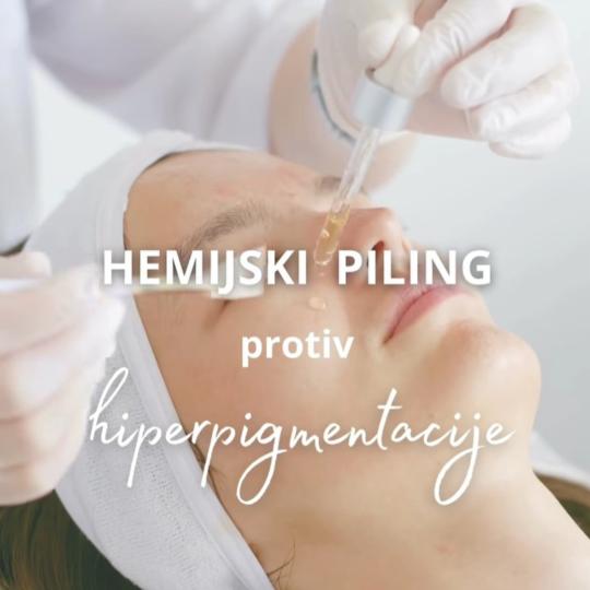 Afrodita gold 2 #kragujevac Tretman lica Hemijski piling lica