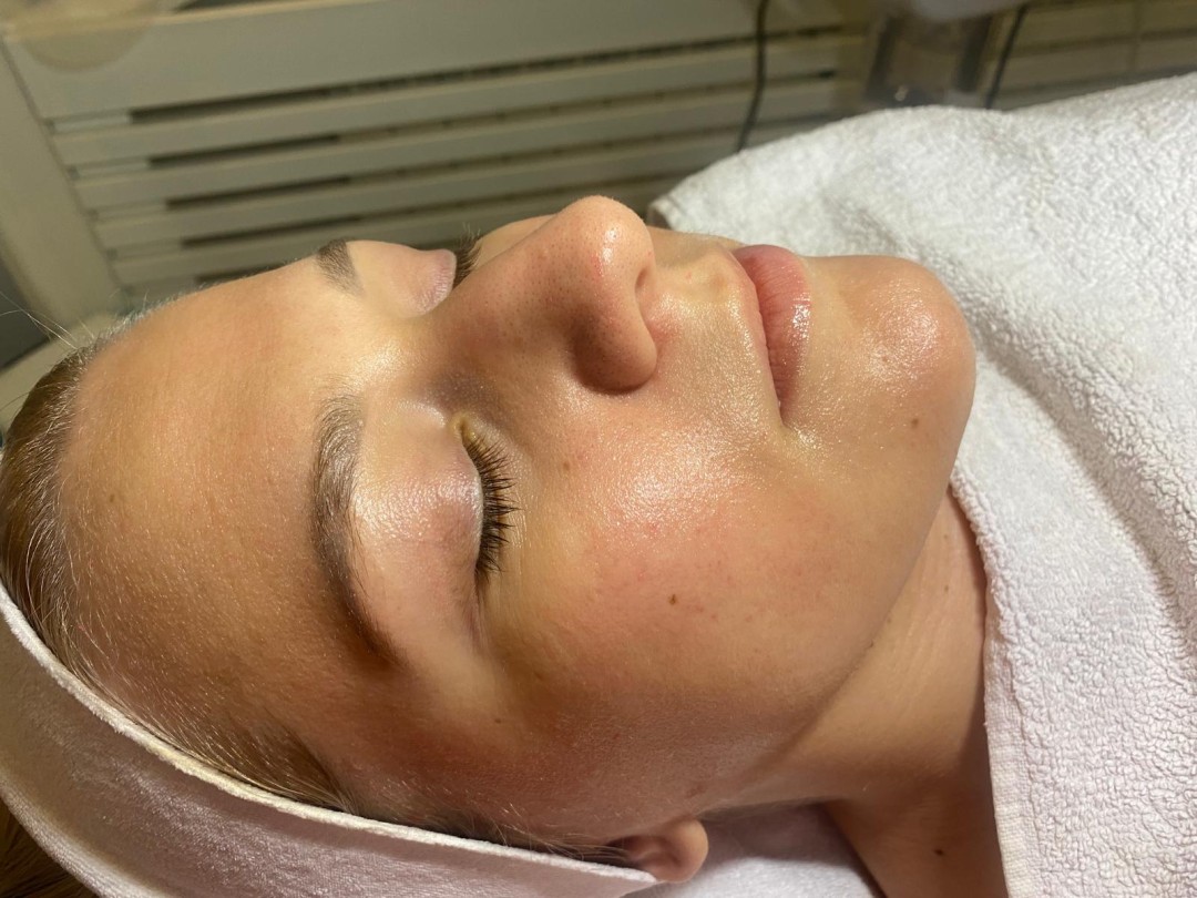 Angels #novisad Tretman lica Masaza lica sa lux maskom Vampire infusion