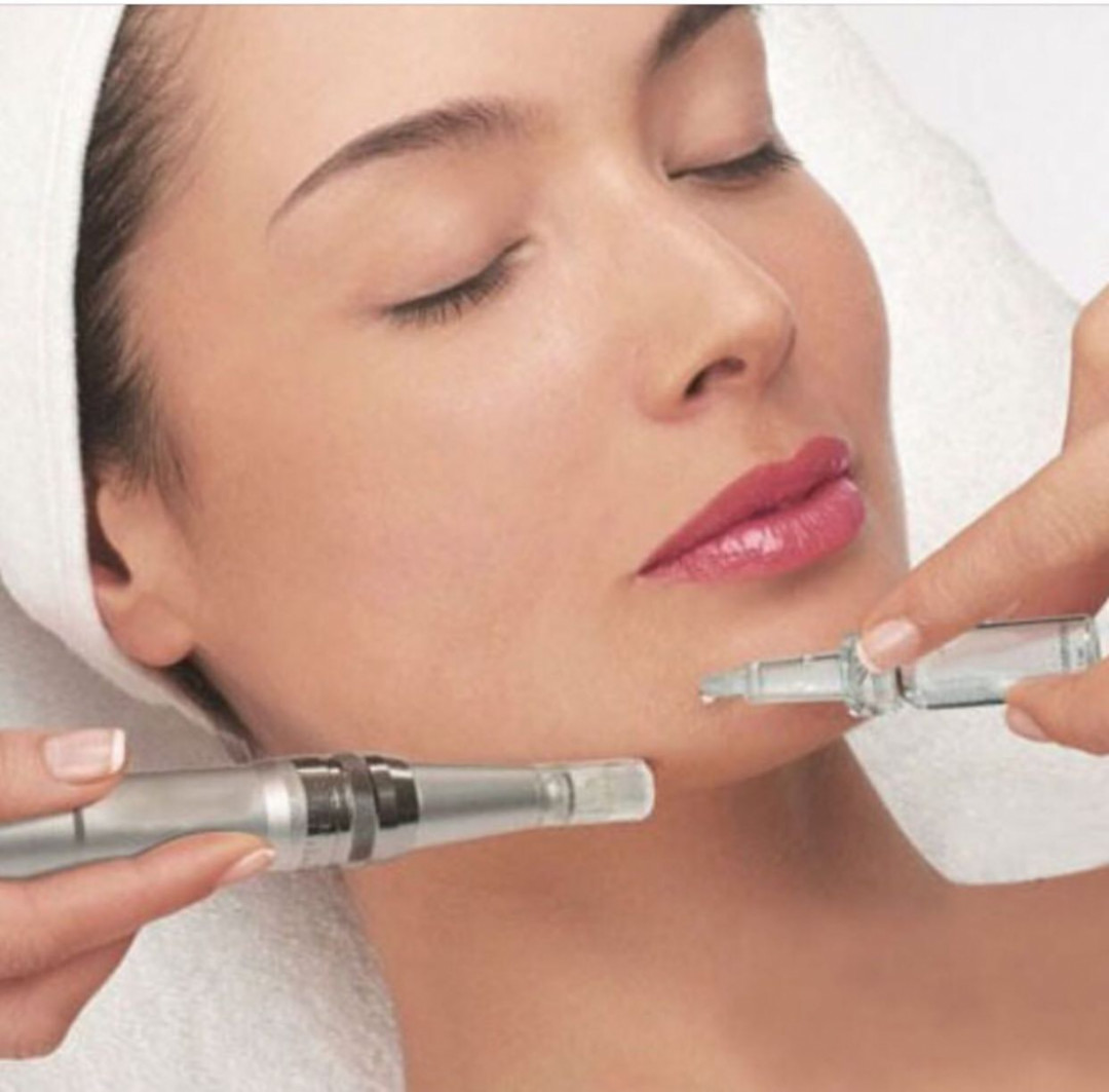 Vortex #beograd Mezoterapija lica Mezoterapija lica dermapenom