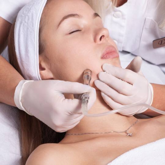 Laser centar Delight #beograd Mikrodermoabrazija Dijamantska mikrodermoabrazija Mikrodermoabrazija i