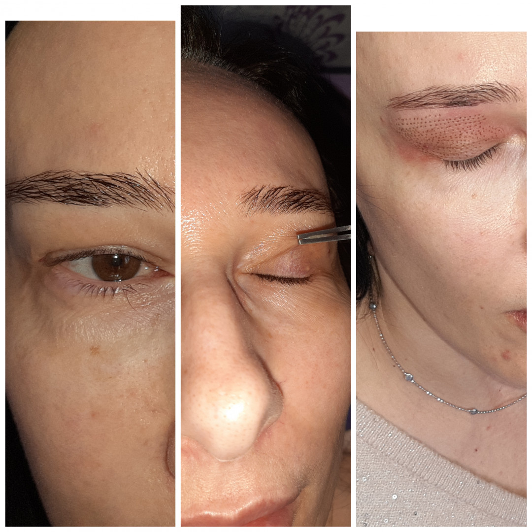 Beauty studio In #beograd Tretman lica