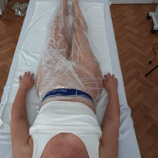 Viva Derm #beograd Tretmani za mršavljenje Vacuslim48