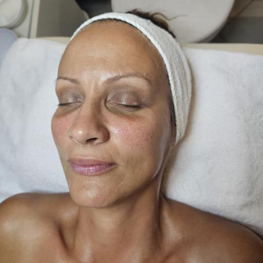 Choco Love #beograd Hijaluronski tretmani lica Oxy tretman lica kiseonikom Dubinska hidratacija
sve