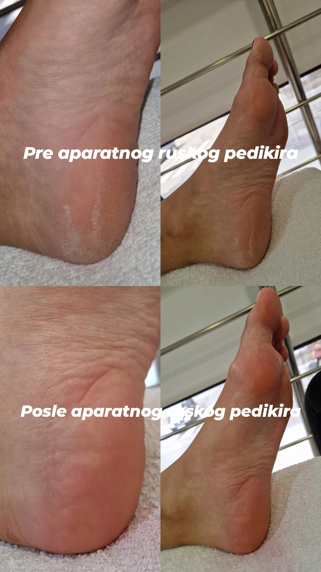 Butik Lepote #beograd Gel lak Aparatni ruski pedikir + gel lak