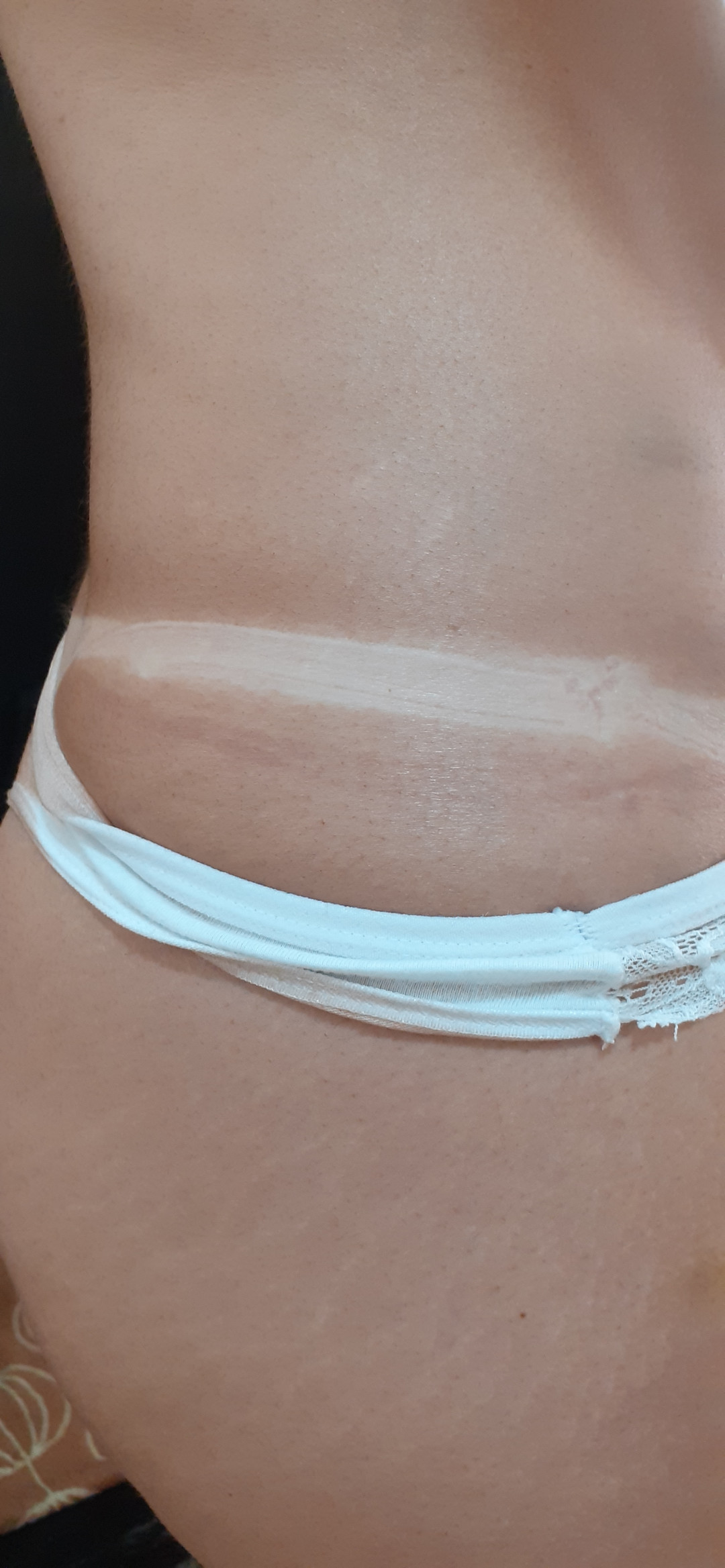 Sana Beauty & Nutrition #beograd Air brush potamnjivanje kože Airbrush