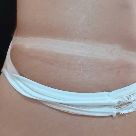 Sana Beauty & Nutrition #beograd Air brush potamnjivanje kože Airbrush
