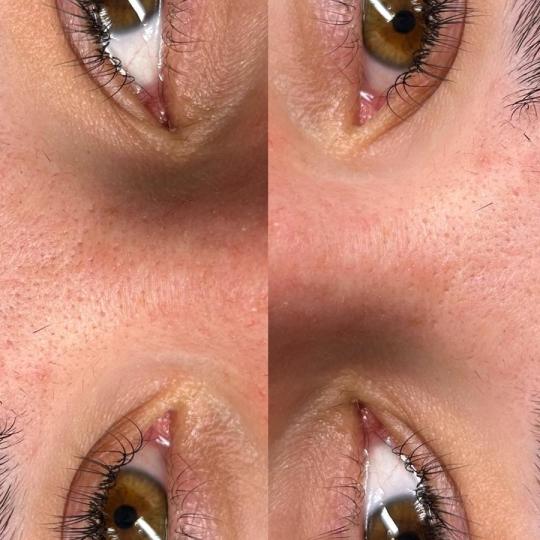 Latina beauty studio #beograd Nadogradnja trepavica Nadogradnja svilenih trepavica - mix metoda Nado