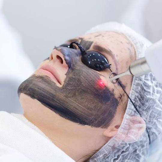 Studio lepote i edukativni centar Helios #kikinda Trajna šminka Laserski piling lica Carbon Peel Tr