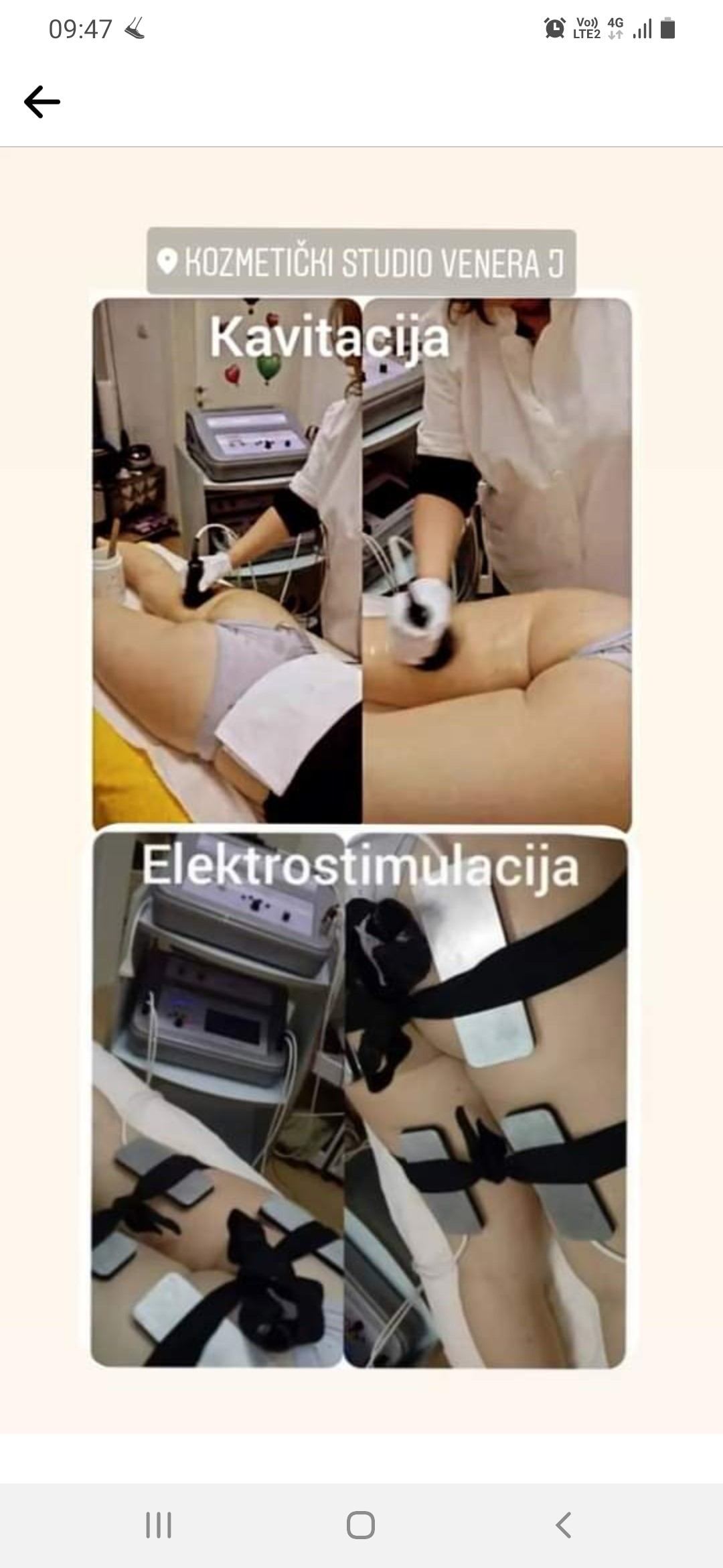 Studio Venera J #beograd Anticelulit masaža Kavitacija + elektrostimulacija - paket od 10 tretmana