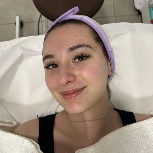 Sandra estetik studio #beograd Tretman lica Hemijski piling lica Zimski reset za mladu kožu ✨
Az