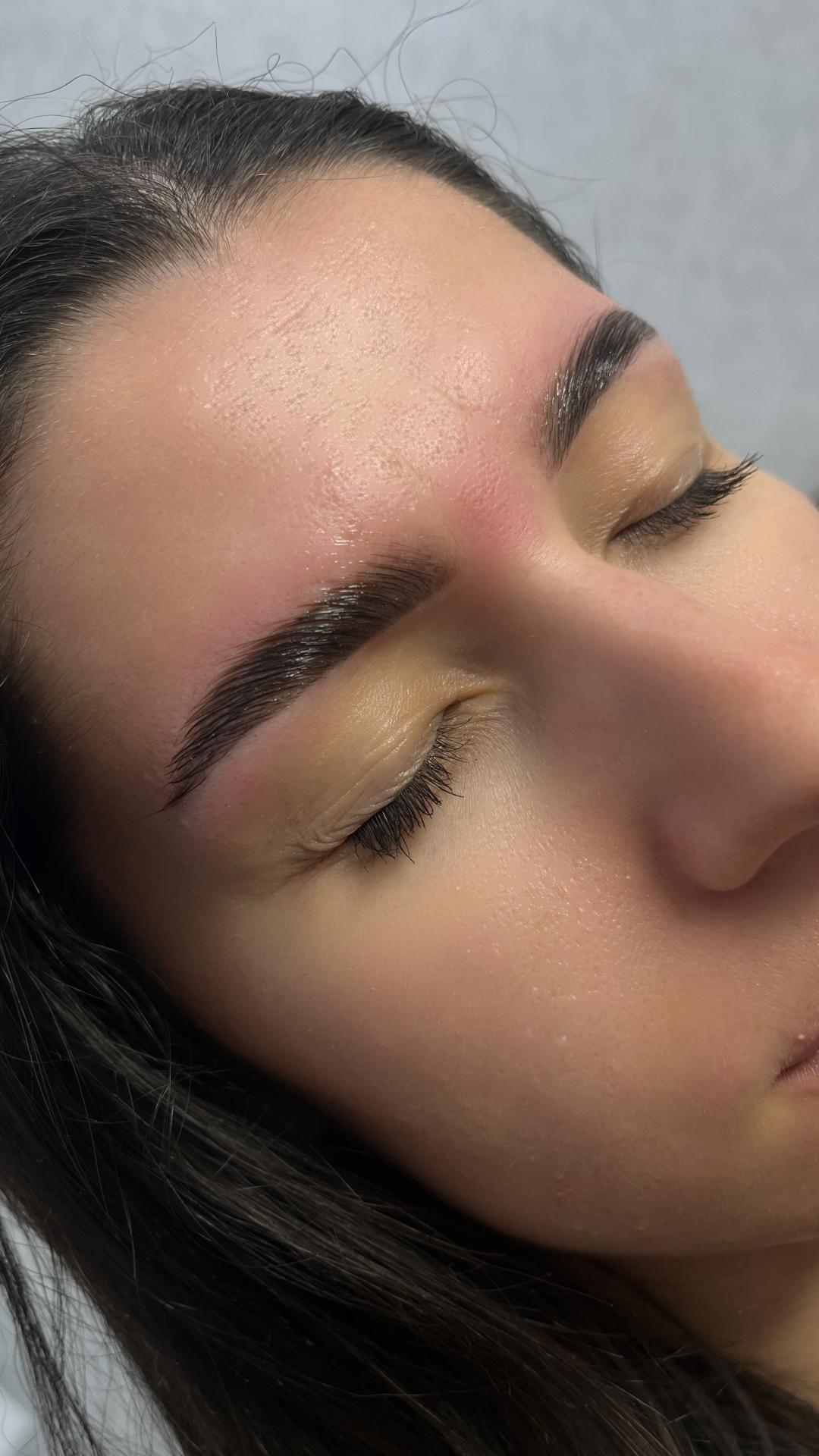 Brow lift - Artist Alex Studio, Niš Obrve Lice Obrve, Niš, Medijana