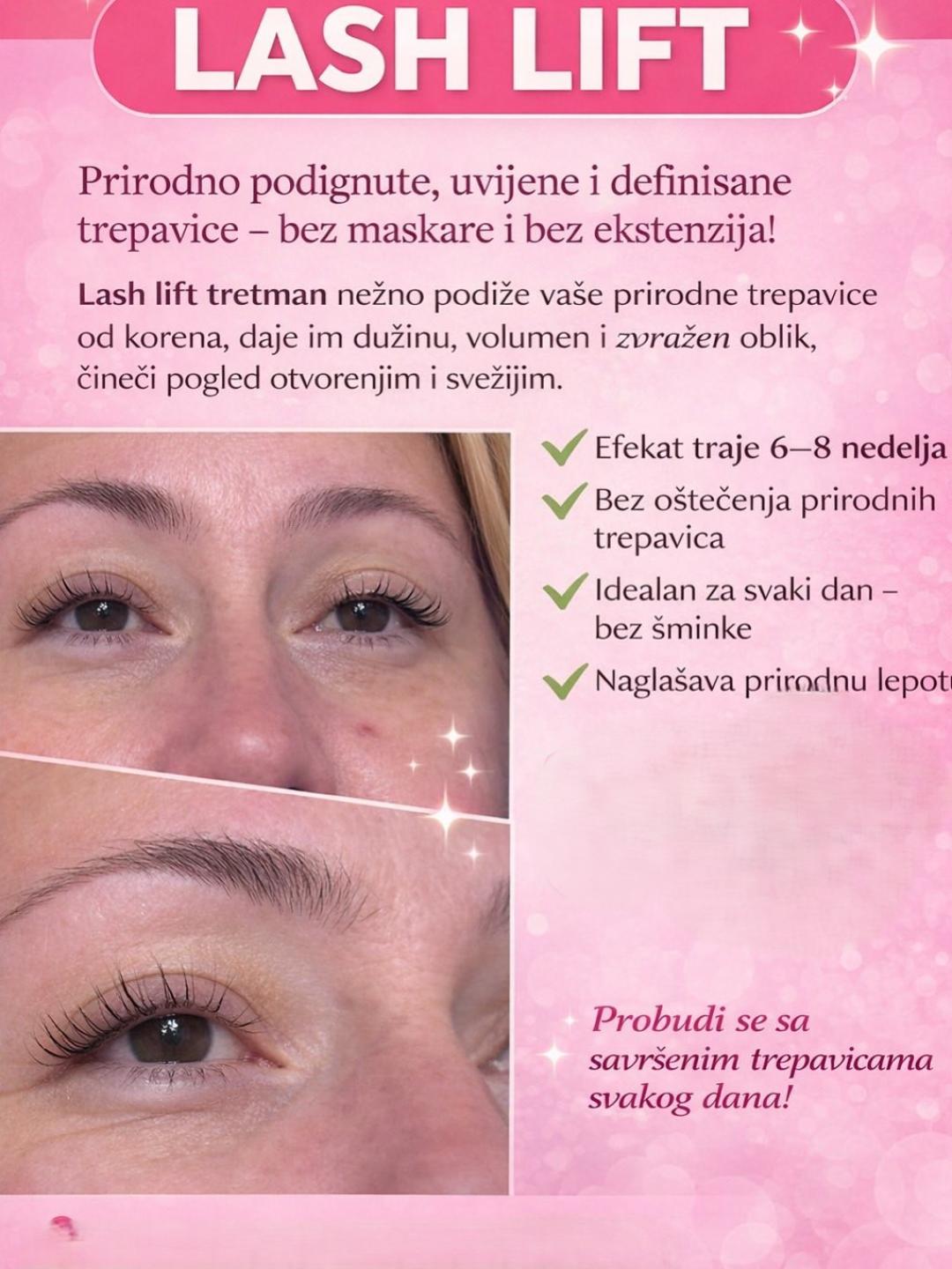 MS Beauty Centar #beograd Trepavice Lash lift