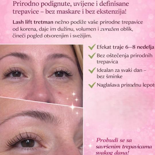 MS Beauty Centar #beograd Trepavice Lash lift