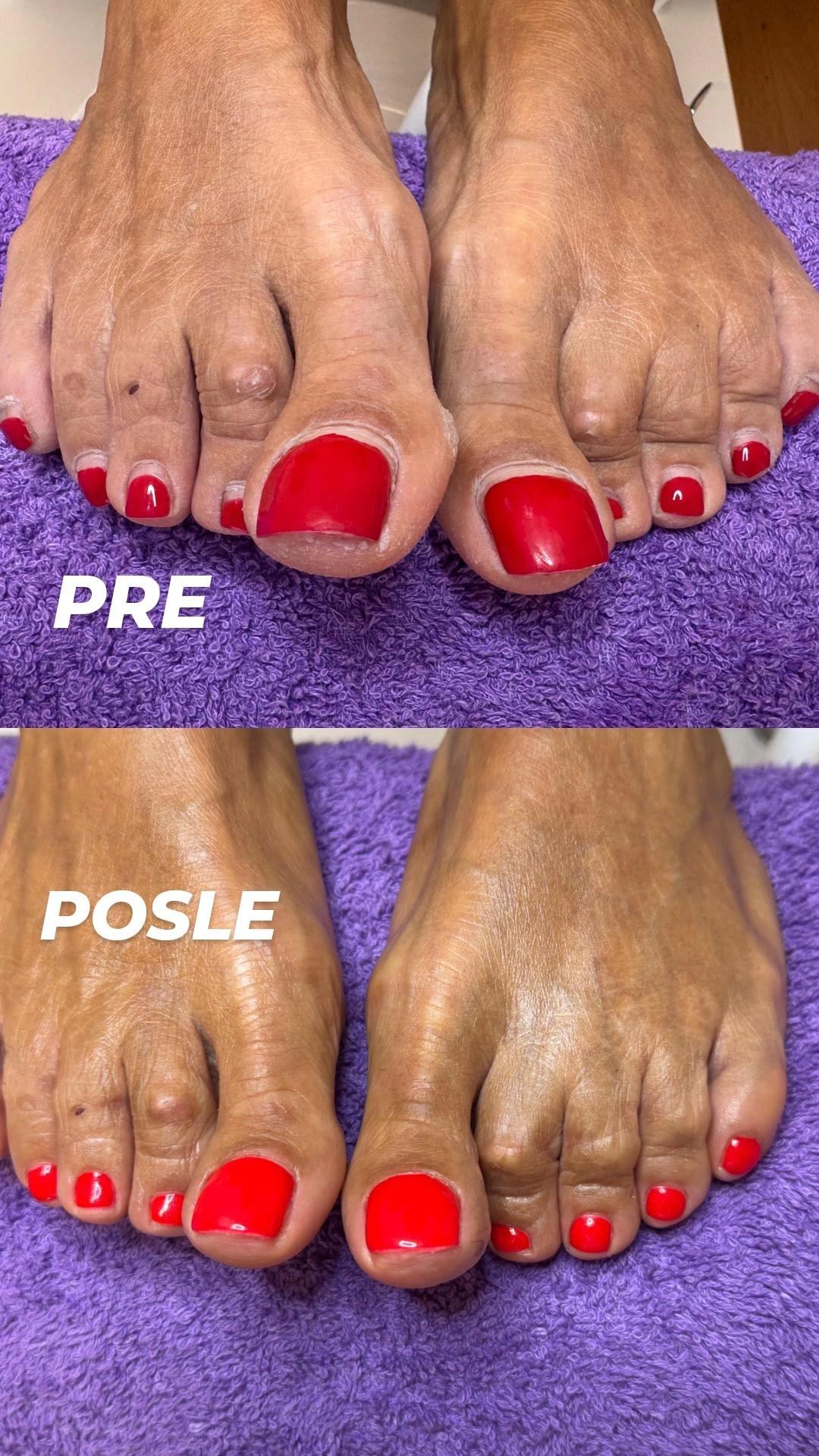 Estetski pedikir + gel lak - Dals Studio by Anica, Novi Sad Estetski pedikir Nokti Estetski pedikir, Novi Sad, Telep, Adice, Bistrica