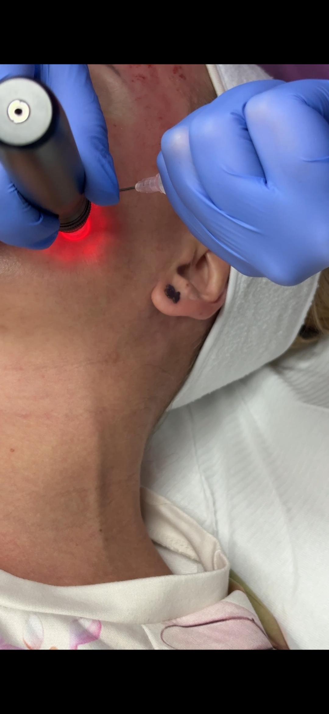 Estetik MPL 87 #beograd